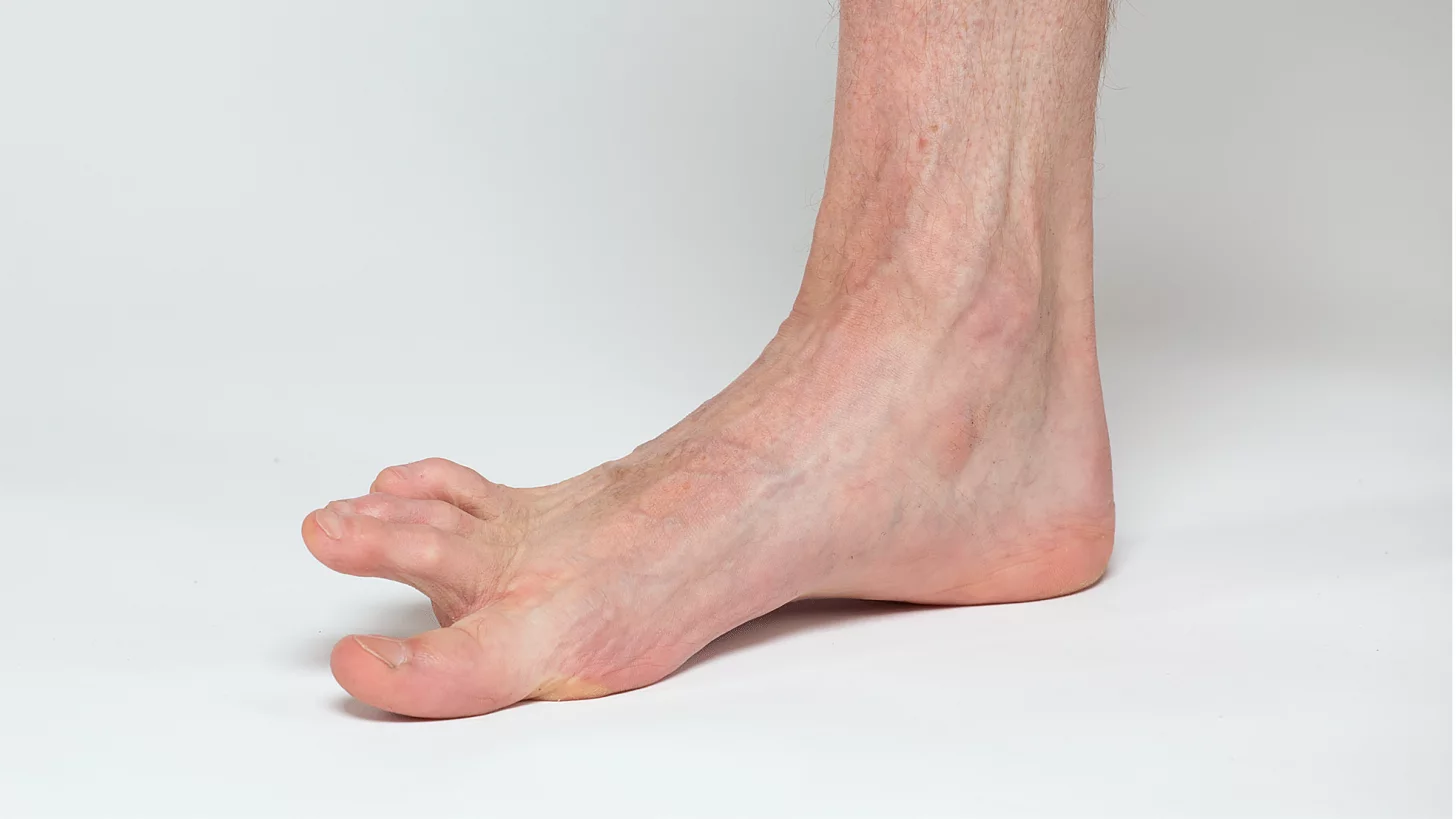 Йога для пальцев ног — эффективный способ предотвратить судороги в стопах при плавании. Йога для пальцев ног — эффективный способ предотвратить судороги в стопах при плавании.